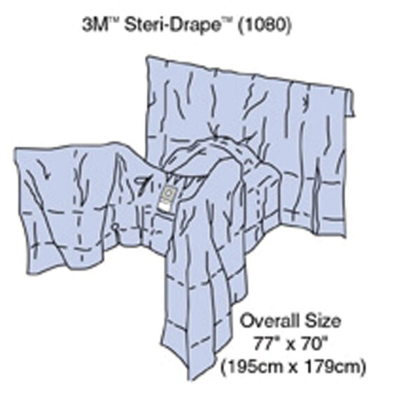 SOLVENTUM OBSTETRICS & GYNECOLOGY DRAPES