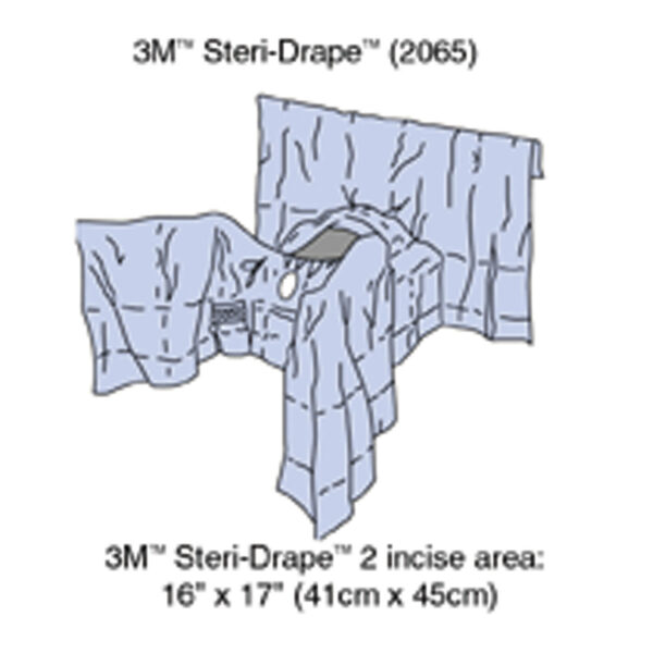 SOLVENTUM GENERAL SURGERY DRAPES